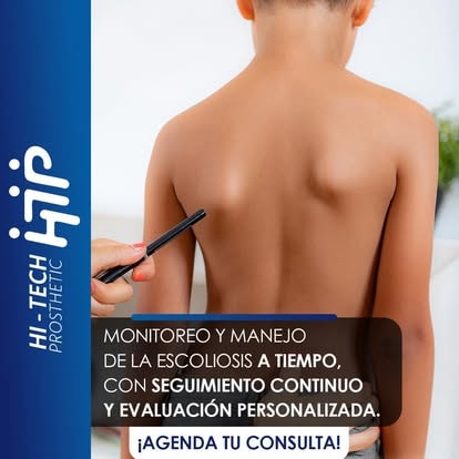 Ajuste de ortesis en clínica